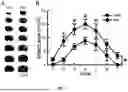 Fig. 04 - Method and Use of Psilocybin in the Prevention and Treatment of Stroke
