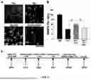 Fig. 07 - Method and Use of Psilocybin in the Prevention and Treatment of Stroke