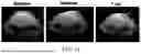 Fig. 12 - MANUFACTURING AND APPLICATION OF MANGANESE-BASED THERANOSTIC NANOPARTICLE TECHNOLOGY