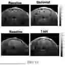 Fig. 14 - MANUFACTURING AND APPLICATION OF MANGANESE-BASED THERANOSTIC NANOPARTICLE TECHNOLOGY