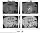 Fig. 15 - MANUFACTURING AND APPLICATION OF MANGANESE-BASED THERANOSTIC NANOPARTICLE TECHNOLOGY