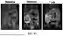 Fig. 16 - MANUFACTURING AND APPLICATION OF MANGANESE-BASED THERANOSTIC NANOPARTICLE TECHNOLOGY