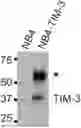 Fig. 01 - COMPOSITIONS AND METHODS FOR TARGETING CD13 AND TIM-3 WITH CAR T CELLS TO TREAT ACUTE MYELOID LEUKEMIA