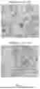 Fig. 03 - LACTOBACILLUS PLANTARUM, LACTIC ACID BACTERIA COMPOSITION AND USE THEREOF FOR TREATING AND/OR PREVENTING HEAVY METAL RELATED DISEASES
