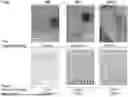 Fig. 01 - POLYVALENT BACTERIOPHAGE COMPOSITIONS AND METHODS FOR TREATMENT OF BACTERIAL INFECTIONS