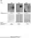 Fig. 03 - POLYVALENT BACTERIOPHAGE COMPOSITIONS AND METHODS FOR TREATMENT OF BACTERIAL INFECTIONS