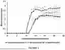 Fig. 02 - GLATIRAMER DEPOT SYSTEMS FOR TREATING PROGRESSIVE FORMS OF MULTIPLE SCLEROSIS