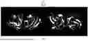 Fig. 09 - METHODS FOR TREATING CATARACTS USING POLYPEPTIDES