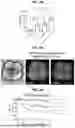 Fig. 11 - COMPOSITIONS AND METHODS FOR THE MODULATION OF PIEZO1 AND TRPV4