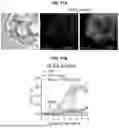 Fig. 28 - COMPOSITIONS AND METHODS FOR THE MODULATION OF PIEZO1 AND TRPV4