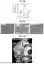 Fig. 32 - COMPOSITIONS AND METHODS FOR THE MODULATION OF PIEZO1 AND TRPV4