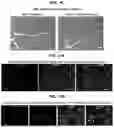 Fig. 42 - COMPOSITIONS AND METHODS FOR THE MODULATION OF PIEZO1 AND TRPV4