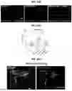 Fig. 61 - COMPOSITIONS AND METHODS FOR THE MODULATION OF PIEZO1 AND TRPV4