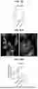 Fig. 75 - COMPOSITIONS AND METHODS FOR THE MODULATION OF PIEZO1 AND TRPV4