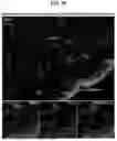 Fig. 87 - COMPOSITIONS AND METHODS FOR THE MODULATION OF PIEZO1 AND TRPV4