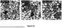 Fig. 08 - METHODS OF TREATING BRONCHOPULMONARY DYSPLASIA
