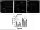 Fig. 10 - METHODS OF TREATING BRONCHOPULMONARY DYSPLASIA