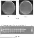 Fig. 04 - METHODS AND COMPOSITIONS FOR METHIONINE RESTRICTION