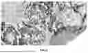 Fig. 02 - BIOMARKERS AND METHODS FOR TREATING NSCLC