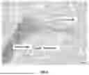 Fig. 03 - BIOMARKERS AND METHODS FOR TREATING NSCLC