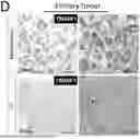 Fig. 01 - TM4SF1 CAR CELLS AND METHODS OF USE THEREOF