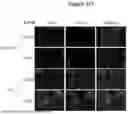 Fig. 10 - PHARMACEUTICAL AGENT CONJUGATES TO MODULATE MACROPHAGE AND INFLAMMATORY FUNCTIONS AND USES THEREOF
