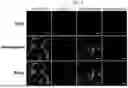 Fig. 04 - BLOOD-NERVE BARRIER TARGETING CONJUGATES AND METHODS OF USE