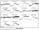 Fig. 15 - LRRC-15-BINDING PROTEIN CONSTRUCTS AND USES THEREOF