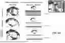 Fig. 10 - METHOD FOR TREATMENT OF MYOTONIC DYSTROPHY COMBINING PROTEIN EXPRESSION AND RNA INTERFERENCE VECTOR DELIVERY WITH TISSUE DETARGETING