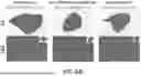 Fig. 17 - METHOD FOR TREATMENT OF MYOTONIC DYSTROPHY COMBINING PROTEIN EXPRESSION AND RNA INTERFERENCE VECTOR DELIVERY WITH TISSUE DETARGETING
