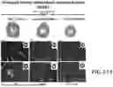 Fig. 23 - METHOD FOR TREATMENT OF MYOTONIC DYSTROPHY COMBINING PROTEIN EXPRESSION AND RNA INTERFERENCE VECTOR DELIVERY WITH TISSUE DETARGETING