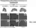 Fig. 24 - METHOD FOR TREATMENT OF MYOTONIC DYSTROPHY COMBINING PROTEIN EXPRESSION AND RNA INTERFERENCE VECTOR DELIVERY WITH TISSUE DETARGETING
