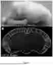 Fig. 05 - COMPOSITIONS AND METHODS FOR TREATING SEQUELAE OF HEARING LOSS