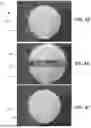 Fig. 05 - WOUND DRESSING WITH SELECTIVE AND DYNAMIC TRANSPARENCY