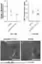 Fig. 10 - APPARATUS FOR DEGRADATION OF AN ACOUSTICALLY RESPONSIVE BIOMATERIAL