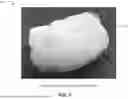 Fig. 08 - ENHANCED OSTEOINDUCTIVE COMPOSITIONS, SYSTEMS, AND METHODS OF MANUFACTURE