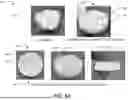Fig. 09 - ENHANCED OSTEOINDUCTIVE COMPOSITIONS, SYSTEMS, AND METHODS OF MANUFACTURE