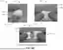 Fig. 10 - ENHANCED OSTEOINDUCTIVE COMPOSITIONS, SYSTEMS, AND METHODS OF MANUFACTURE