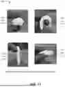 Fig. 13 - ENHANCED OSTEOINDUCTIVE COMPOSITIONS, SYSTEMS, AND METHODS OF MANUFACTURE