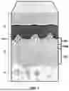 Fig. 02 - DERMIS DERIVED ALLOGRAFTS AND METHODS FOR PREPARING SAME