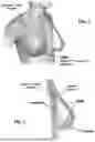 Fig. 03 - DERMIS DERIVED ALLOGRAFTS AND METHODS FOR PREPARING SAME