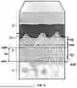 Fig. 04 - DERMIS DERIVED ALLOGRAFTS AND METHODS FOR PREPARING SAME