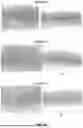 Fig. 08 - DERMIS DERIVED ALLOGRAFTS AND METHODS FOR PREPARING SAME