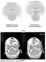 Fig. 08 - INJECTABLE DOSIMETER COMPOSITIONS AND METHODS OF USING SAME
