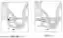 Fig. 03 - EXOSOME BONE GRAFT SYSTEMS, PRODUCTS AND METHODS