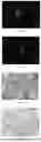 Fig. 05 - Piezoelectric Conductive Composite Stent And Preparation Method Thereof