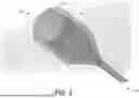 Fig. 04 - SYSTEMS AND METHODS FOR TRANSLUMINAL ENDOSCOPIC VACUUM