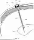 Fig. 03 - IMPLANTABLE INTRAVENTRICULAR SAMPLING AND INFUSION ACCESS DEVICE