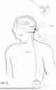 Fig. 06 - IMPLANTABLE INTRAVENTRICULAR SAMPLING AND INFUSION ACCESS DEVICE