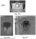 Fig. 22 - DEVICE AND METHOD FOR AEROSOLIZED DELIVERING OF SUBSTANCE TO A NATURAL ORIFICE OF THE BODY